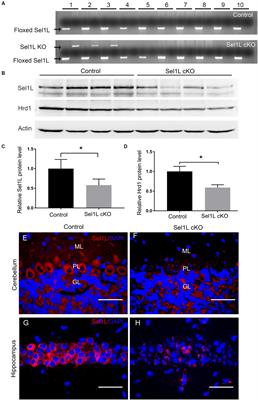 Endoplasmic reticulum associated degradation preserves neurons viability by maintaining endoplasmic reticulum homeostasis